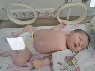 Малката София се нуждае от нашата помощ! Историята на една майчина любов