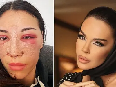 Бистра от "Островът" си клъцна носа като Галена и Богданска СНИМКИ