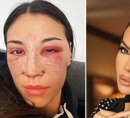 Бистра от "Островът" си клъцна носа като Галена и Богданска СНИМКИ