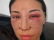 Бистра от "Островът" си клъцна носа като Галена и Богданска СНИМКИ