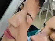 Бистра от "Островът" си клъцна носа като Галена и Богданска СНИМКИ