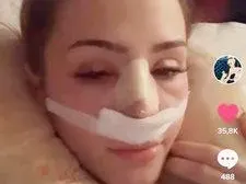 Бистра от "Островът" си клъцна носа като Галена и Богданска СНИМКИ