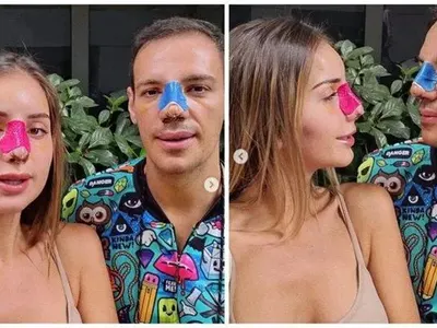 Бистра от "Островът" си клъцна носа като Галена и Богданска СНИМКИ