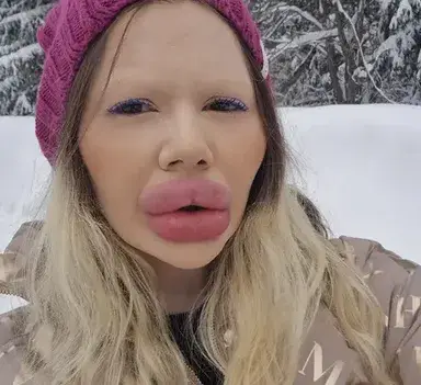 Българското Барби е ЩАСТЛИВА: Моите устни са най-големите в света! (ШОК ВИДЕО)