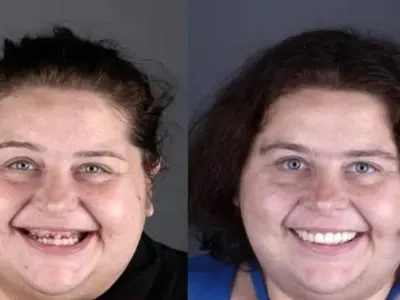 Най-тежката българка с нови зъби и 80 кг надолу (Снимки)