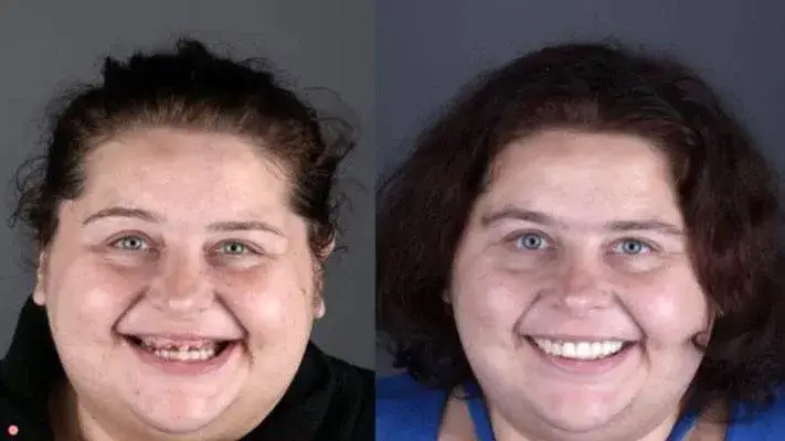 Най-тежката българка с нови зъби и 80 кг надолу (Снимки)