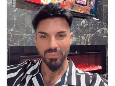 Нападат и Благо Джизъса заради хиалурона в устните (СНИМКИ)