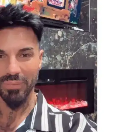 Нападат и Благо Джизъса заради хиалурона в устните (СНИМКИ)