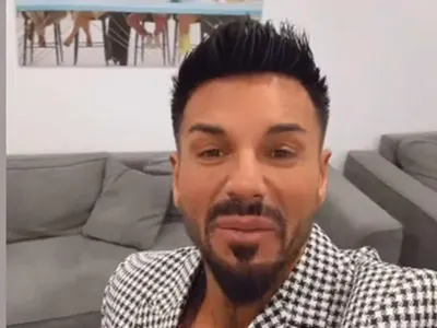 Нападат и Благо Джизъса заради хиалурона в устните (СНИМКИ)