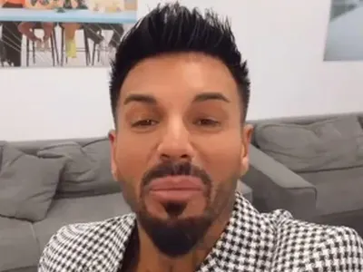 Нападат и Благо Джизъса заради хиалурона в устните (СНИМКИ)