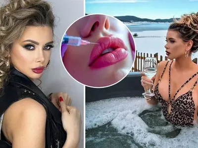 И "Мис Вселена" Кристина Пламенова ЖЕРТВА на ботокс