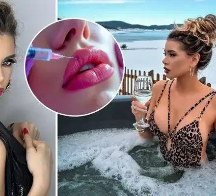 И "Мис Вселена" Кристина Пламенова ЖЕРТВА на ботокс