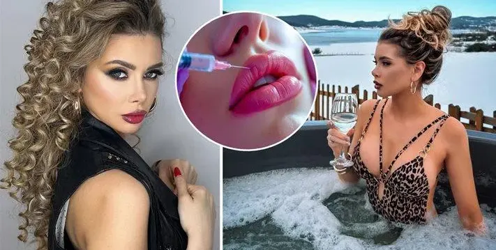 И "Мис Вселена" Кристина Пламенова ЖЕРТВА на ботокс