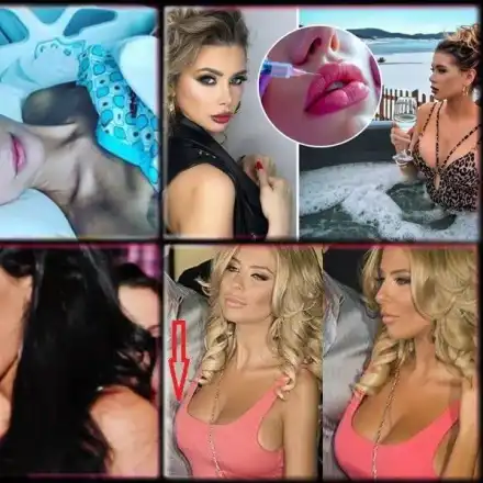 И те плачат: Миски, жертва на разкрасяването