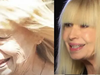 Лили ще съди агенцията, която я "прати" на лифтинг в Турция