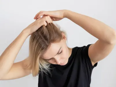 Най-честите проблеми със скалпа – как да ги предотвратим