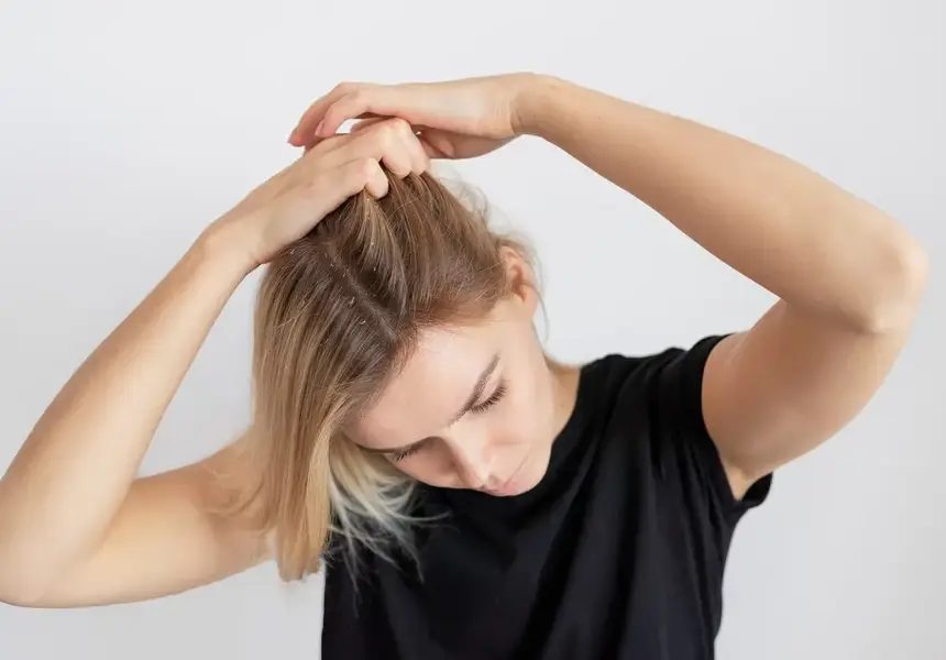 Най-честите проблеми със скалпа – как да ги предотвратим