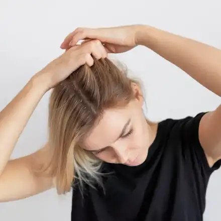 Най-честите проблеми със скалпа – как да ги предотвратим