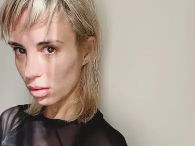 Насред скандала: Радина се наблъска с БОТОКС (Снимки)