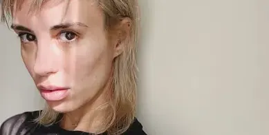 Насред скандала: Радина се наблъска с БОТОКС (Снимки)