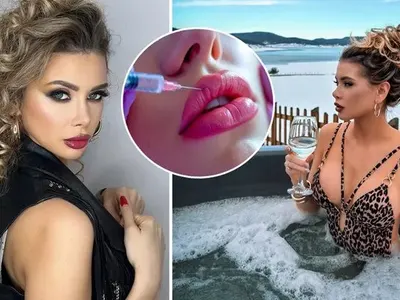 УЖАС!! И ергенката Кристина Пламенова изрева от ботокс: Очите ми се затвориха, не можех да виждам, а сега съм с бръчки! (ВИЖ ТУК)