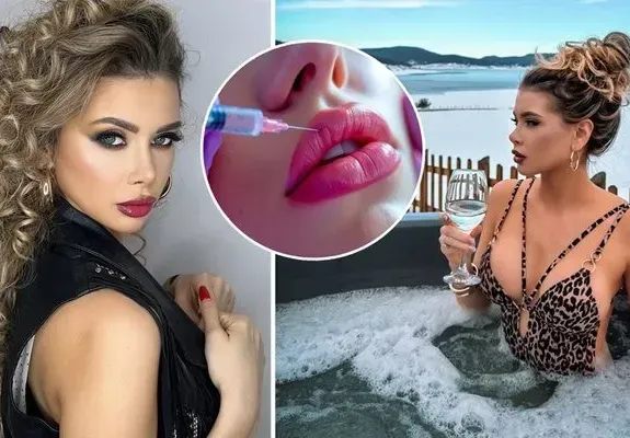 УЖАС!! И ергенката Кристина Пламенова изрева от ботокс: Очите ми се затвориха, не можех да виждам, а сега съм с бръчки! (ВИЖ ТУК)
