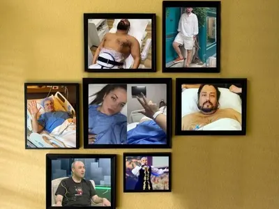 Звезди се вталяват със „стомашен пръстен“ СНИМКИ