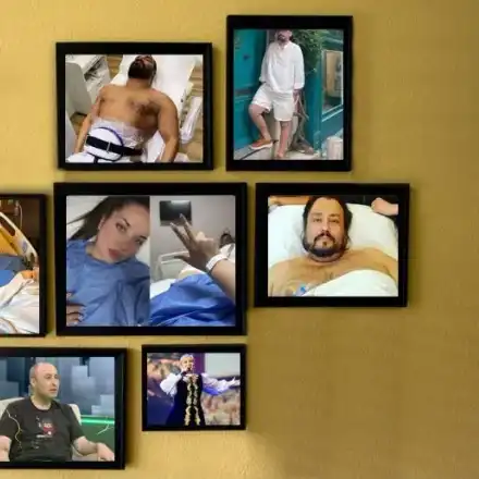 Звезди се вталяват със „стомашен пръстен“ СНИМКИ