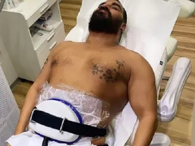 Звезди се вталяват със „стомашен пръстен“ СНИМКИ