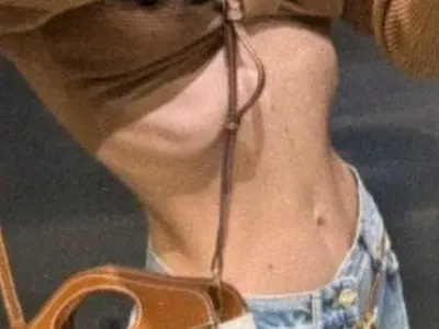 И Мис България отслабва с Оземпик? Стана 40 кг! (Шокиращи снимки)