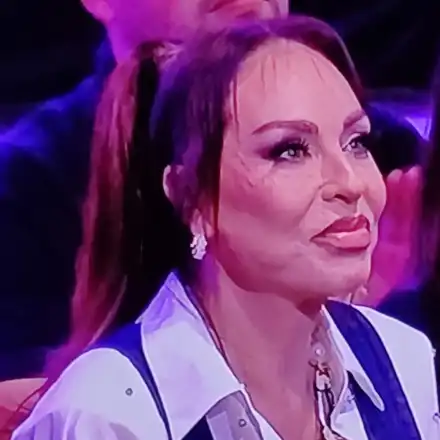 КОНФУЗ! Лъснаха в ефир мезоконците по лицето на Ивана (СНИМКИ)