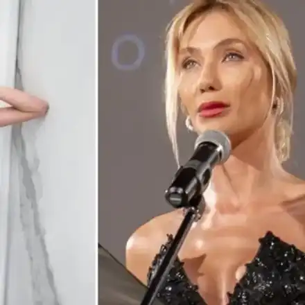 Носът на Райна Караянева щял да се разпадне като на Майкъл Джексън СНИМКИ