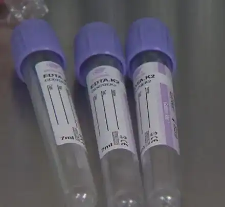 Ще се реши ли проблемът с фалшивите тестове за наркотици?