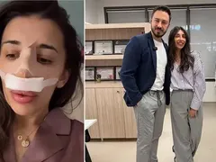 Уволнена от БФС ергенка си ремонтира носа (Ужасяващи снимки)