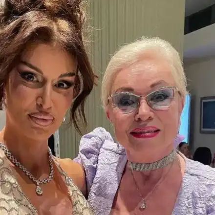 Дъщерята на Искра Радева се ОБЕЗОБРАЗИ от корекции