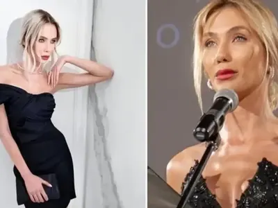 Носът на Райна Караянева щял да се разпадне като на Майкъл Джексън