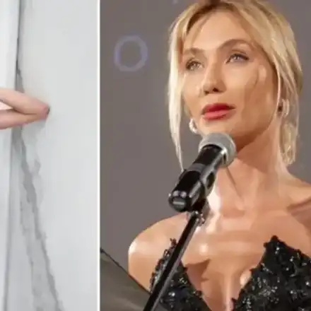 Носът на Райна Караянева щял да се разпадне като на Майкъл Джексън