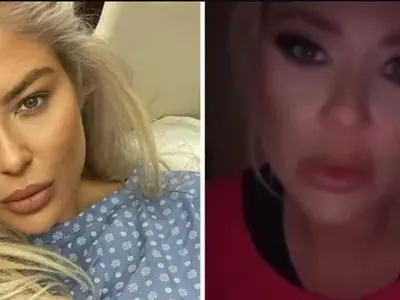 Андреа бледа и подпухнала от болницата: Зле съм! (Подробности)