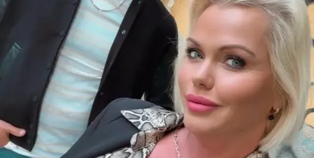 Асдис Ран изгори бюста - гледката е болезнена