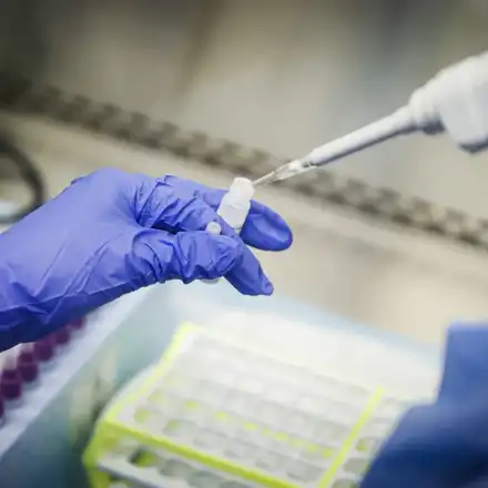 Донор на сперма е предал на 52 деца ген, причиняващ рак, сред засегнатите може да е и България