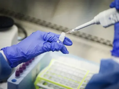 Донор на сперма е предал на 52 деца ген, причиняващ рак, сред засегнатите може да е и България