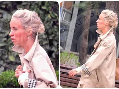 ФОТО БОМБА: Кой ОБЕЗОБРАЗИ устните на Радина Кърджилова?! (устата й е тройна, а тя се е прегърбила от слабост - СНИМКИ)