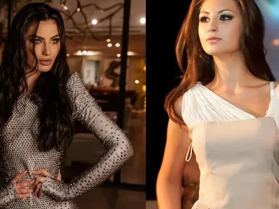 Мис България нямала никакви корекции! (Вижте я преди 10 години със сменено лице)