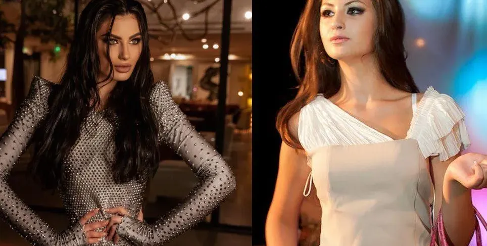 Мис България нямала никакви корекции! (Вижте я преди 10 години със сменено лице)