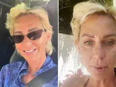 Нана още се бори с пораженията от ботокса