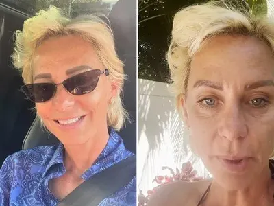 Нана още се бори с пораженията от ботокса