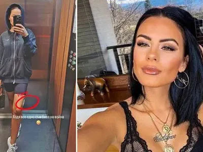 Ново нещастие! Жената на Криско се контузи