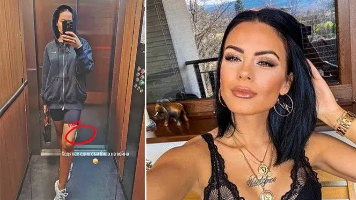 Ново нещастие! Жената на Криско се контузи