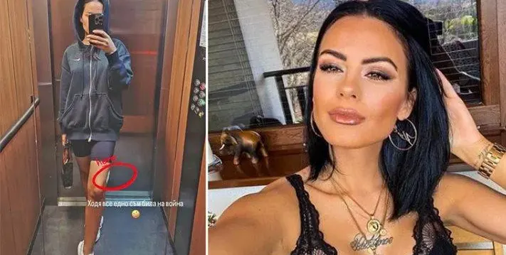 Ново нещастие! Жената на Криско се контузи