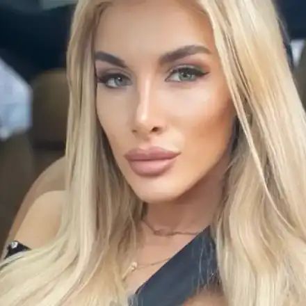 Зарязаната Мис Нос се закачи за нов милионер